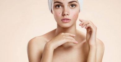 Akne-Haut richtig pflegen – Mythen und Tatsachen über Akne